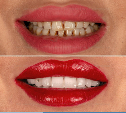 Slider image (9) Dis 212 - Dental Aesthetics Facility